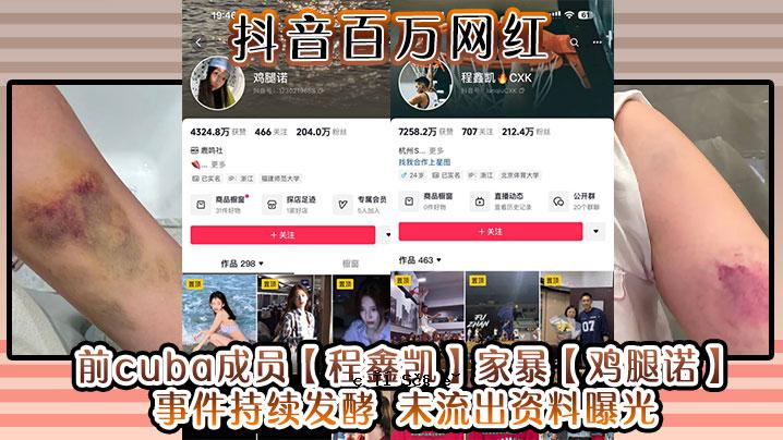抖音10万网红上一篇古巴成功故事辛卡家暴鸡诺事件曝光数据泄露